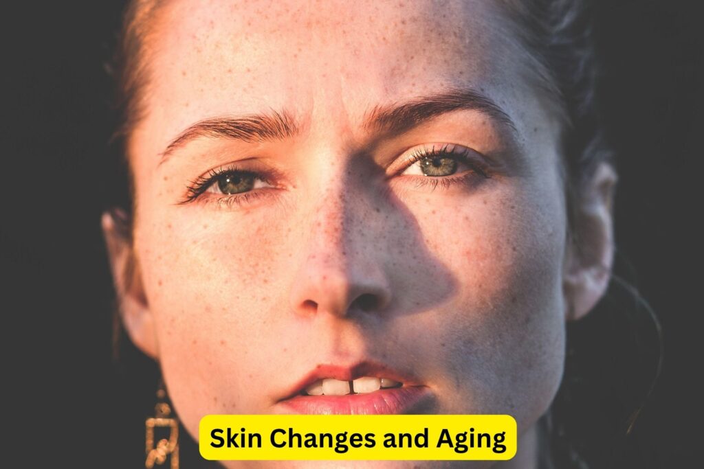 Skin Changes and Aging